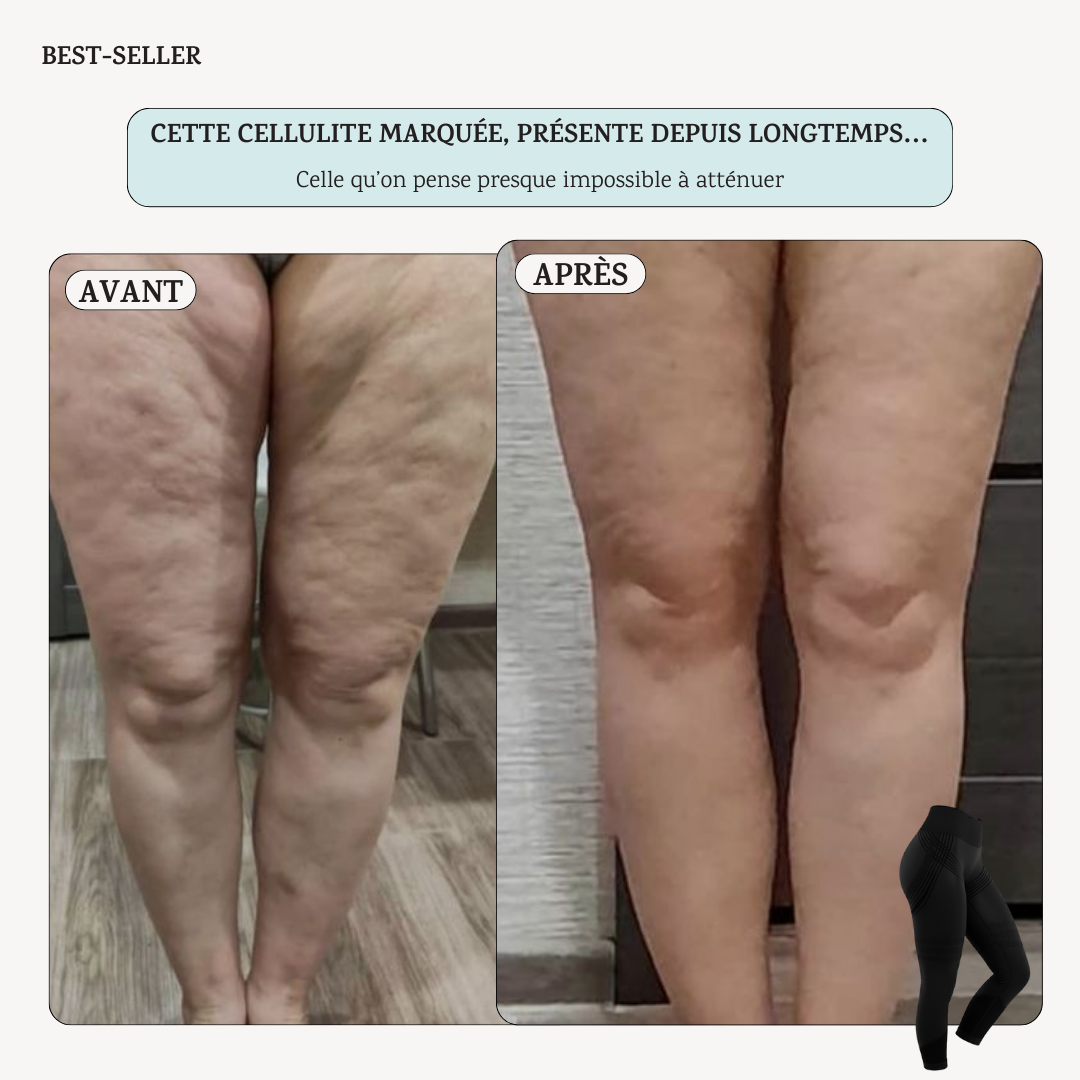 Legging 3D Anti-Cellulite