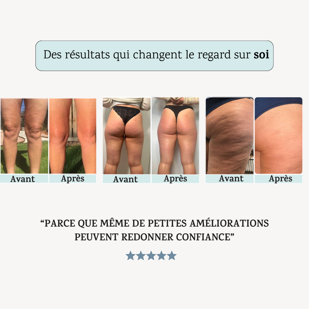 Legging 3D Anti-Cellulite